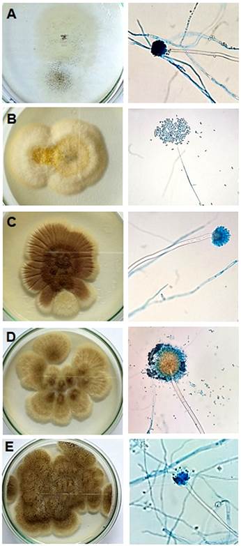 Características a nivel de macrocultivo
y microcultivo de cepas aisladas de Aspergillus sp. (A)
Fusarium sp. (B) Aspergillus sp. (C) Aspergillus sp. (D) y Penicillium sp. (E).